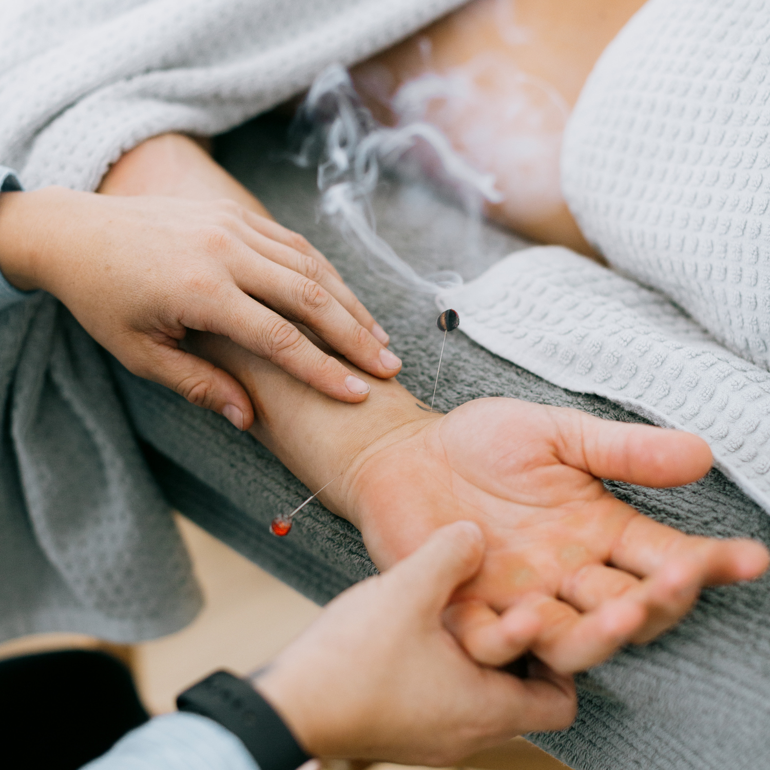 Vyne Health Acupuncture Gold Coast