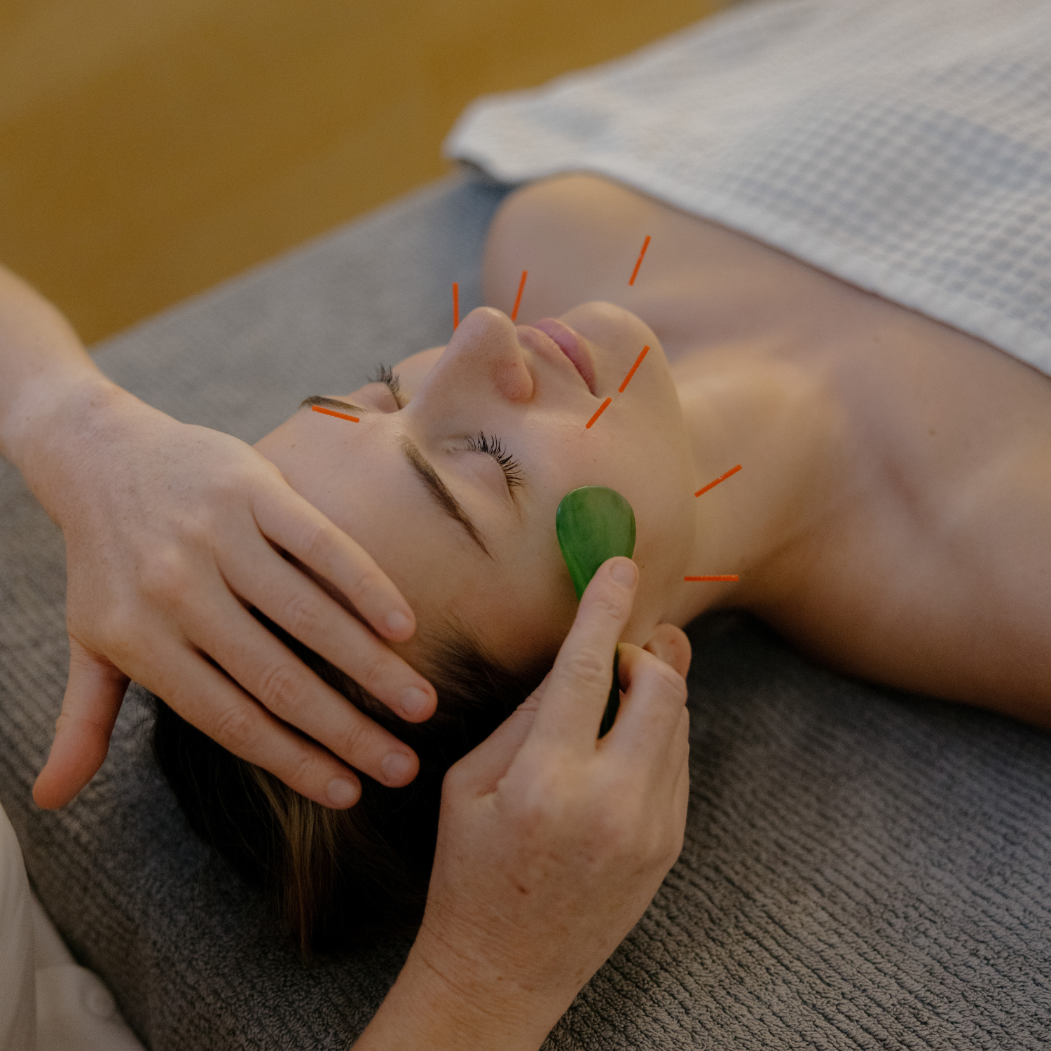 Cosmetic Acupuncture Gold Coast - Vyne Health