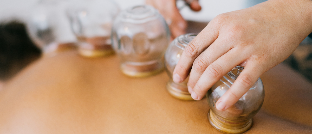 Fire cupping treatment with glass cups along the back at Vyne Health, Gold Coast