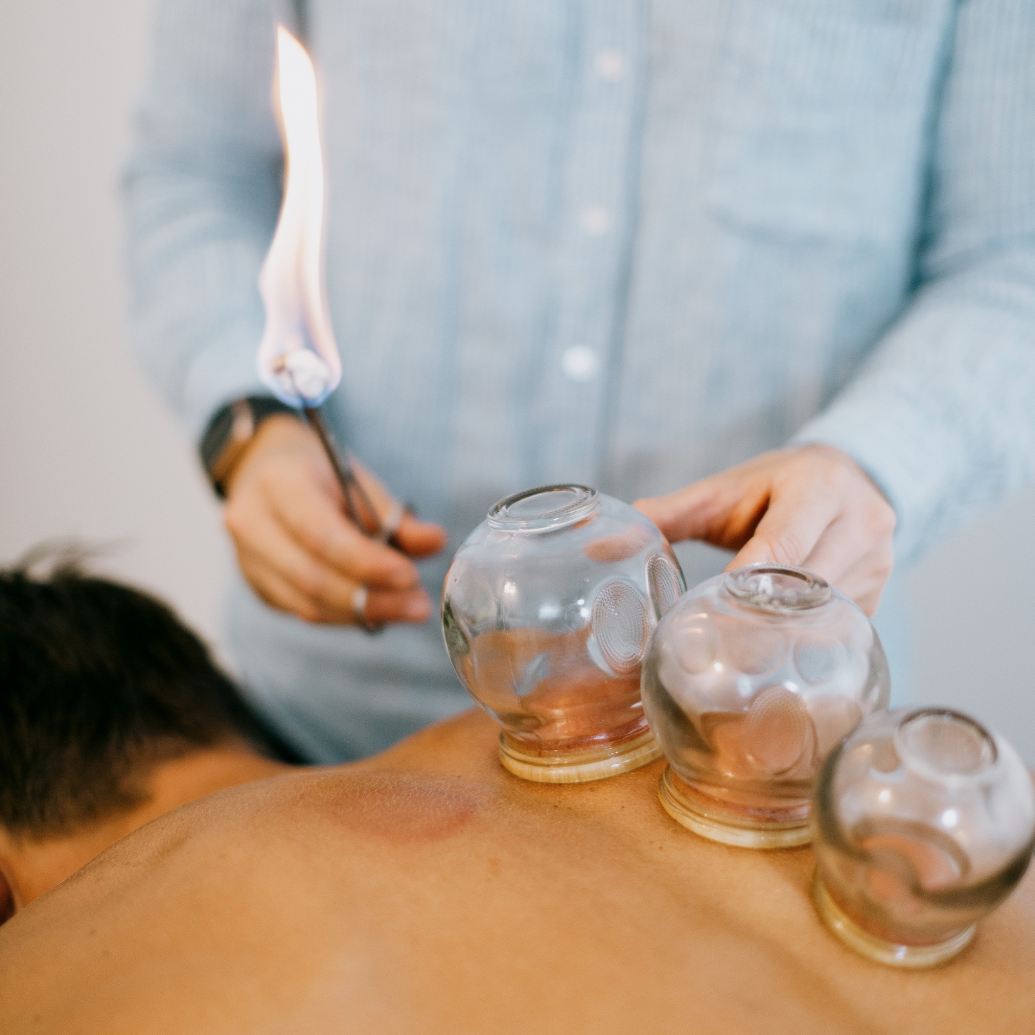 Gold Coast Acupuncture Clinic - Vyne Health