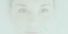Acupuncture for Stress, Anxiety and Depression Gold Coast